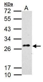 CLEC5A Polyclonal Antibody