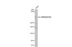 SETD2 Polyclonal Antibody