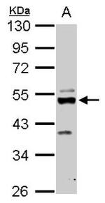 C9orf72 Antibody in Western Blot (WB)