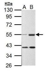 C9orf72 Antibody in Western Blot (WB)