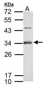RSPO1 Polyclonal Antibody