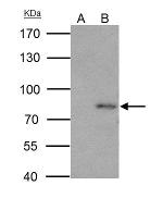 PAK6 Antibody in Immunoprecipitation (IP)