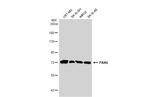 PAK6 Antibody in Western Blot (WB)