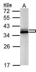 hnRNP A2B1 Antibody in Western Blot (WB)