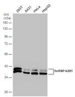 hnRNP A2B1 Antibody in Western Blot (WB)