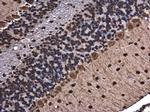 hnRNP A2B1 Antibody in Immunohistochemistry (Paraffin) (IHC (P))