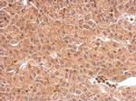 DCTD Polyclonal Antibody