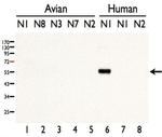 Avian Influenza H5N1 Neuraminidase Polyclonal Antibody
