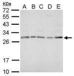 HOXD8 Antibody in Western Blot (WB)