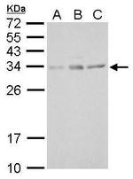 UCP4 Polyclonal Antibody
