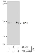 CEP152 Antibody in Immunoprecipitation (IP)