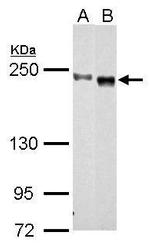 CEP152 Antibody in Western Blot (WB)