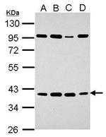 HEY2 Polyclonal Antibody