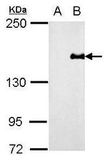 PREX1 Antibody in Western Blot (WB)