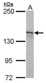 ULK1 Antibody in Western Blot (WB)