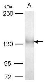 ULK1 Antibody in Western Blot (WB)