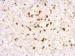 Porcine Circovirus Type 2 Capsid Antibody in Immunohistochemistry (Paraffin) (IHC (P))