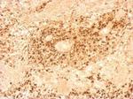 Porcine Circovirus Type 2 Capsid Antibody in Immunohistochemistry (Paraffin) (IHC (P))