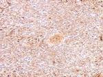 Porcine Circovirus Type 2 Capsid Polyclonal Antibody