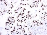 Phospho-RAD17 (Ser646) Antibody in Immunohistochemistry (Paraffin) (IHC (P))