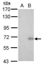 Phospho-RAD17 (Ser646) Antibody in Western Blot (WB)