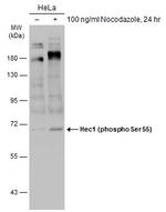 Phospho-HEC1 (Ser55) Antibody in Western Blot (WB)