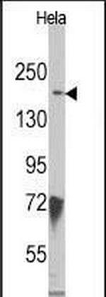 JMJD3 Antibody in Western Blot (WB)