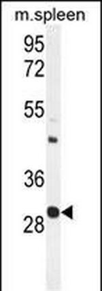 USF1 Antibody in Western Blot (WB)