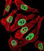 FOXA2 Polyclonal Antibody
