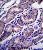 FOXA2 Antibody in Immunohistochemistry (Paraffin) (IHC (P))