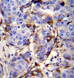 GCDFP-15 Antibody in Immunohistochemistry (Paraffin) (IHC (P))