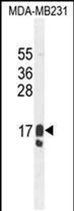 GCDFP-15 Antibody in Western Blot (WB)