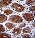 CPSF3L Antibody in Immunohistochemistry (Paraffin) (IHC (P))