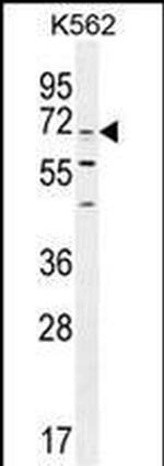 CPSF3L Antibody in Western Blot (WB)