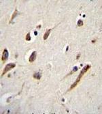 FBXW11 Antibody in Immunohistochemistry (Paraffin) (IHC (P))