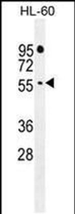 FBXW11 Antibody in Western Blot (WB)