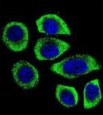 PIP5KL1 Antibody in Immunocytochemistry (ICC/IF)
