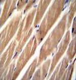 PIP5KL1 Antibody in Immunohistochemistry (Paraffin) (IHC (P))