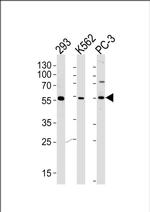 PIP5KL1 Antibody in Western Blot (WB)