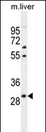 PHOX2B Antibody in Western Blot (WB)