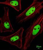 KRBA2 Antibody in Immunocytochemistry (ICC/IF)