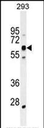 KRBA2 Antibody in Western Blot (WB)