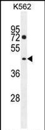 PM20D2 Antibody in Western Blot (WB)