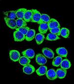 ANKRD34B Antibody in Immunocytochemistry (ICC/IF)