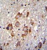 ANKRD34B Antibody in Immunohistochemistry (Paraffin) (IHC (P))