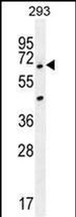 ANKRD34B Antibody in Western Blot (WB)