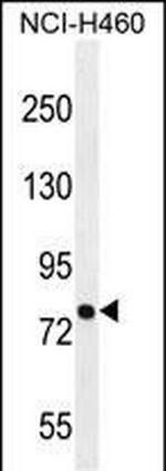 PNN Antibody in Western Blot (WB)