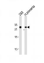 TCF21 Antibody in Western Blot (WB)