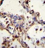 WDR52 Antibody in Immunohistochemistry (Paraffin) (IHC (P))