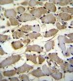 ZMYND17 Antibody in Immunohistochemistry (Paraffin) (IHC (P))